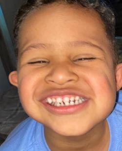 Fundraising Page Image